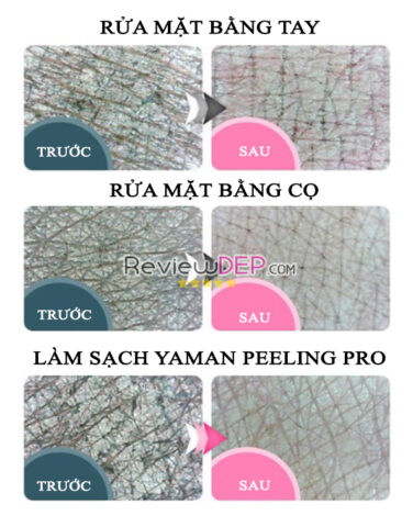 Review máy Yaman Circle Peeling Pro - SO SÁNH