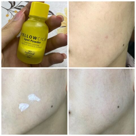 Review chấm mụn Yellow Cica Spot Hàn Quốc - Hình ảnh chia sẻ bởi Hoai Linh Pham