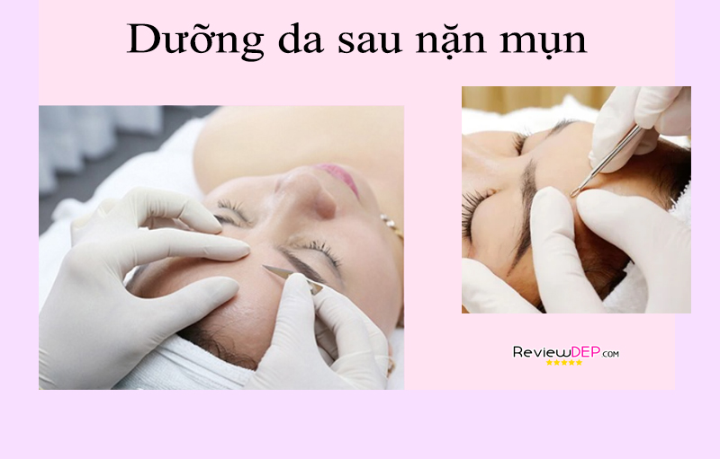 Dưỡng da sau nặn mụn (Lưu ý 3 ngày đầu tiên)